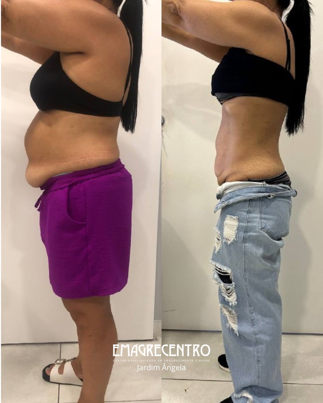 Antes e depois — redução de medidas corporais